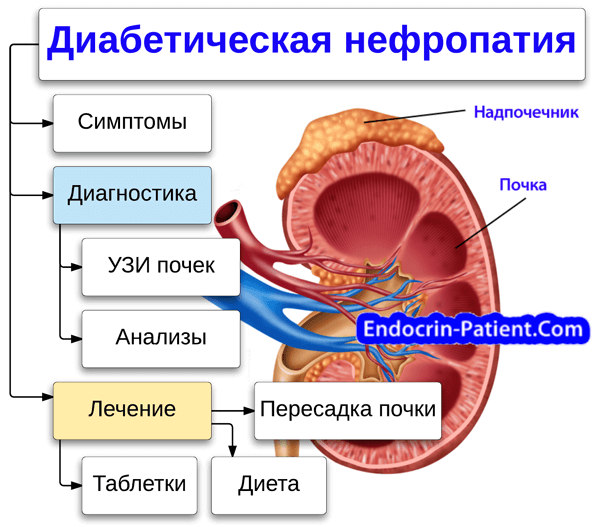 Почечный диабет. Диабетическая нефропатия (патология почек);. Сахарный диабет нефропатия. Диабетическая нефропатия при сахарном диабете 1 типа. Диабетическая нефропатия почки препарат.